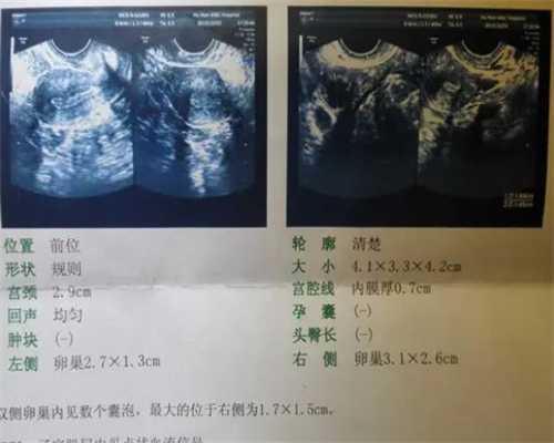 试管二代能知道性别吗&中国助孕网,高龄胎停备孕怎么调理