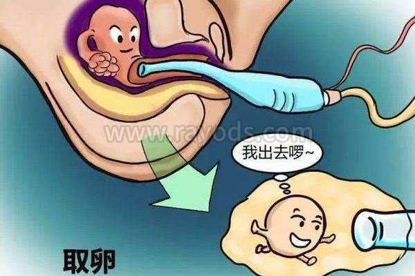岐山县代孕费用多少,试管婴儿的过程中女方需要进行取卵相关知识点_孕妇梦见